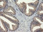 UBE2G2 Antibody in Immunohistochemistry (Paraffin) (IHC (P))