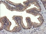 UBE2G2 Antibody in Immunohistochemistry (Paraffin) (IHC (P))