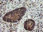 UBE2G2 Antibody in Immunohistochemistry (Paraffin) (IHC (P))