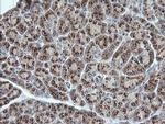 UBE2G2 Antibody in Immunohistochemistry (Paraffin) (IHC (P))