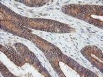 UBE2G2 Antibody in Immunohistochemistry (Paraffin) (IHC (P))