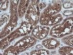 UBE2G2 Antibody in Immunohistochemistry (Paraffin) (IHC (P))