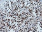 UBE2G2 Antibody in Immunohistochemistry (Paraffin) (IHC (P))