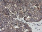 UBE2G2 Antibody in Immunohistochemistry (Paraffin) (IHC (P))