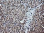 UBE2G2 Antibody in Immunohistochemistry (Paraffin) (IHC (P))