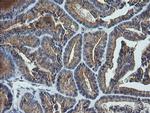 UBE2G2 Antibody in Immunohistochemistry (Paraffin) (IHC (P))