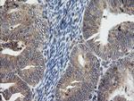 UBE2G2 Antibody in Immunohistochemistry (Paraffin) (IHC (P))