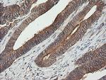 UBE2G2 Antibody in Immunohistochemistry (Paraffin) (IHC (P))