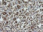 UBE2G2 Antibody in Immunohistochemistry (Paraffin) (IHC (P))