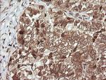 UBE2G2 Antibody in Immunohistochemistry (Paraffin) (IHC (P))