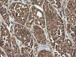 UBE2G2 Antibody in Immunohistochemistry (Paraffin) (IHC (P))