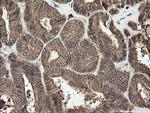 UBE2G2 Antibody in Immunohistochemistry (Paraffin) (IHC (P))