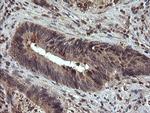 UBE2G2 Antibody in Immunohistochemistry (Paraffin) (IHC (P))