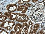 UBE2G2 Antibody in Immunohistochemistry (Paraffin) (IHC (P))