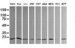 UBE2G2 Antibody in Western Blot (WB)