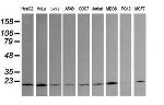 UBE2G2 Antibody in Western Blot (WB)