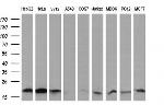 UBE2G2 Antibody in Western Blot (WB)