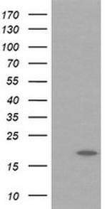 UBE2G2 Antibody in Western Blot (WB)