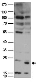 UBE2I Antibody in Western Blot (WB)