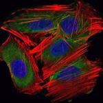 UBC9 Antibody in Immunocytochemistry (ICC/IF)