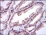 UBC9 Antibody in Immunohistochemistry (Paraffin) (IHC (P))