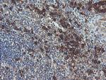 UBE2J1 Antibody in Immunohistochemistry (Paraffin) (IHC (P))