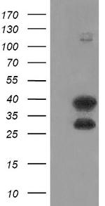 UBE2J1 Antibody in Western Blot (WB)