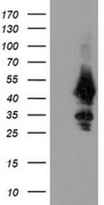 UBE2J1 Antibody in Western Blot (WB)