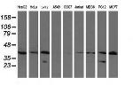 UBE2J1 Antibody in Western Blot (WB)