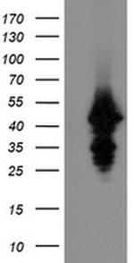 UBE2J1 Antibody in Western Blot (WB)