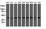 UBE2J1 Antibody in Western Blot (WB)