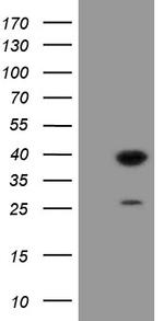 UBE2J1 Antibody in Western Blot (WB)