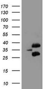 UBE2J1 Antibody in Western Blot (WB)