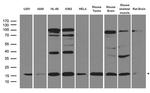 UBE2L3 Antibody in Western Blot (WB)