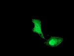 UBE2M Antibody in Immunocytochemistry (ICC/IF)