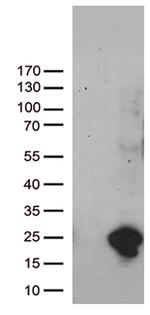 UBE2NL Antibody in Western Blot (WB)