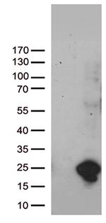 UBE2NL Antibody in Western Blot (WB)