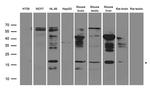 UBE2NL Antibody in Western Blot (WB)