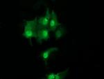 UBE2S Antibody in Immunocytochemistry (ICC/IF)