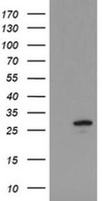 UBE2S Antibody in Western Blot (WB)