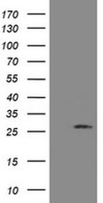 UBE2S Antibody in Western Blot (WB)