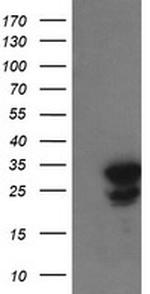 UBE2S Antibody in Western Blot (WB)