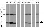 UBE2T Antibody in Western Blot (WB)