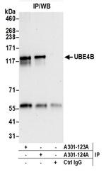 UBE4B Antibody in Western Blot (WB)