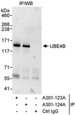 UBE4B Antibody in Immunoprecipitation (IP)