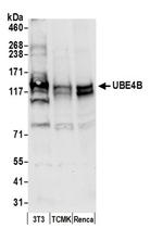 UBE4B Antibody in Western Blot (WB)