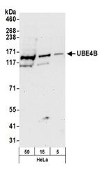 UBE4B Antibody in Western Blot (WB)