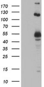 UBOX5 Antibody in Western Blot (WB)