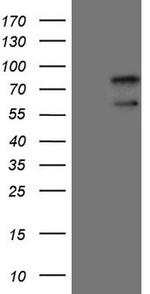 UBP1 Antibody in Western Blot (WB)