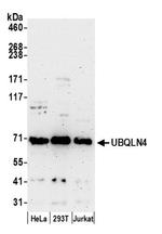 UBQLN4/CIP75/Ubiquilin 4 Antibody in Western Blot (WB)